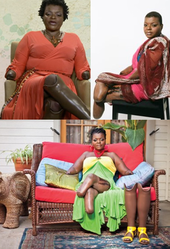 Apryl Michelle Brown, amputees des quatre membres