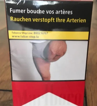 Un sexagenaire retrouve la photo de sa jambe amputee sur des paquets de cigarettes, sans son accord, a Metz (France)