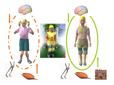 Taitement TheraSuit pour paralys(e) crbral(e)